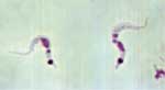 Trypanosoma cruzi in triatomine bugs chagas disease Trypanosoma cruzi in triatomine bugs chagas disease
